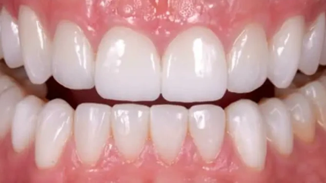 Después: Estética Avanzada