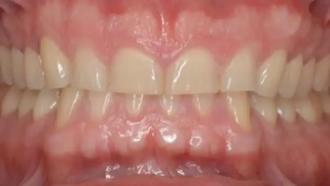 Antes: Estética Avanzada