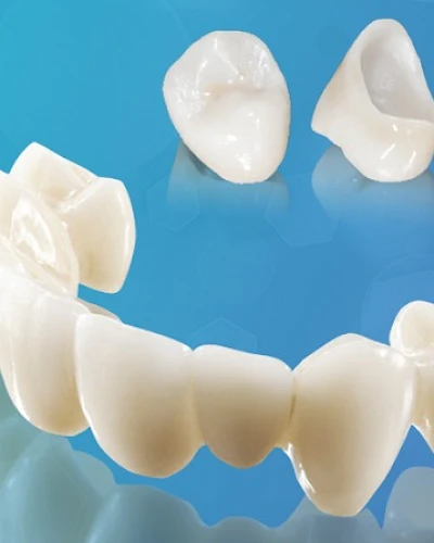 Rehabilitación de Circonio