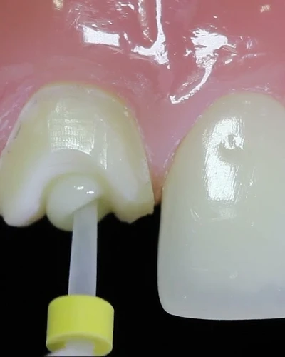 Pernos de Fibra de Vidrio